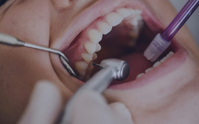 Understanding Cavities & Fillings: Expert Advice from La Marque Family Dentistry