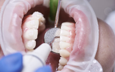 Enhance Your Smile: Importance of Regular Exams at La Marque Dentistry