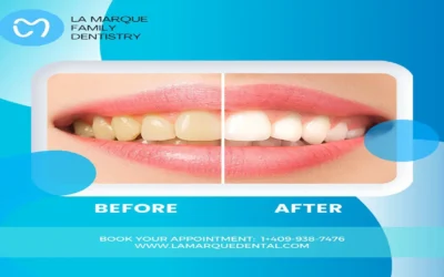 Cosmetic Dentistry in La Marque : Enhancing Your Smile One Visit at a Time